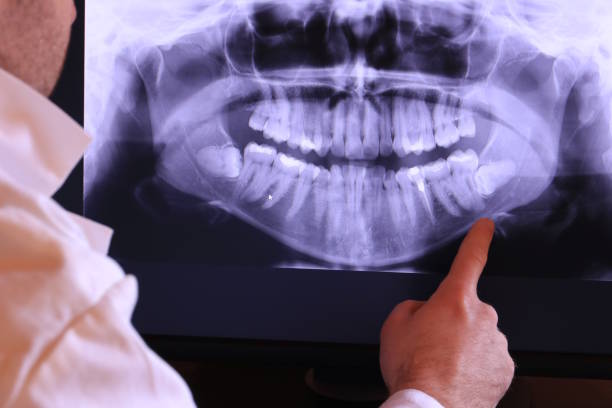 Best Emergency Dental Extractions in Carlisle Rockledge, AL